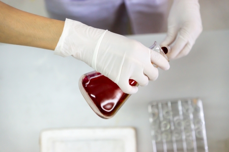 Red titrand in Erlenmeyer flask pour in to test tubeの写真素材