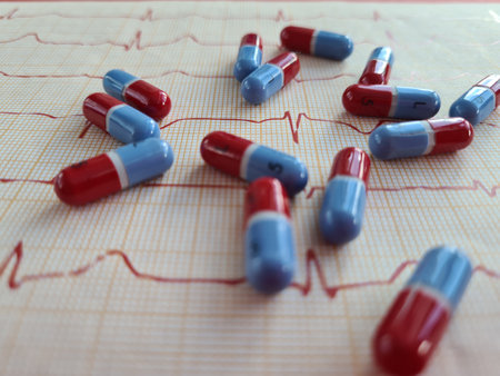 Electrocardiogram and medical pills for treatment of heart diseases. Treatment of angina pectoris...
