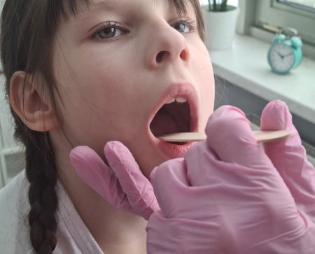 Doctor conducts physical examination of throat of little girl. Angina in children concept