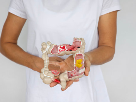 Model of human anatomy with intestine ulcer and oncologyの写真素材