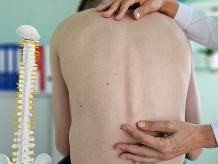 Surgeon examines spine and posture scoliosis and spinal deformities in a teenager. Teenager with a problem with the spine and stoopの写真素材