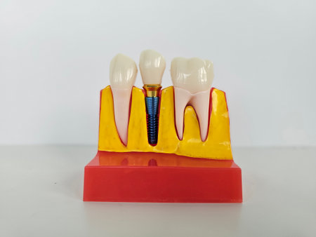 Educational model of gum with dental implant