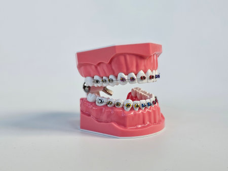 Model of human teeth with braces for educational purposes in dental training environmentの写真素材