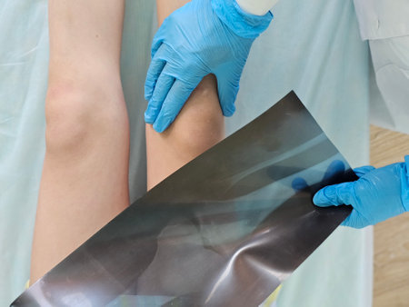 Orthopedic traumatologist examination of the knee with x-ray in clinical conditions and routine...