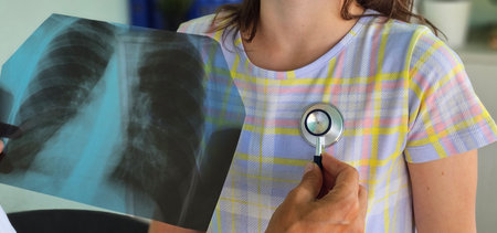 Patient receiving lung examination with stethoscope and chest X-ray in medical officeの写真素材