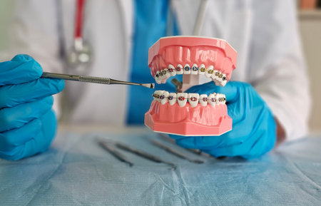 Orthodontist demonstrating dental braces model during patient consultation in a clinicの写真素材