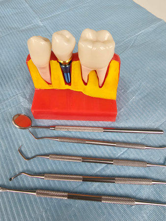 Dental tools and model showcasing dental care and education techniques for oral hygiene practices