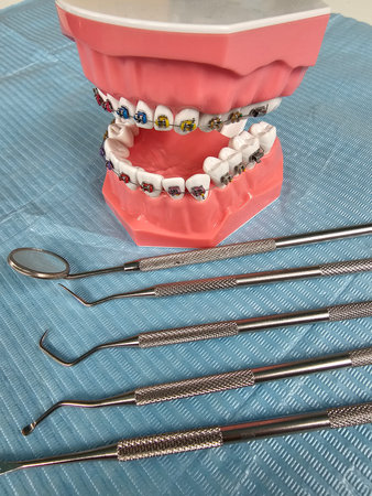 Dental model with colorful braces and examination tools displayed on a blue surface