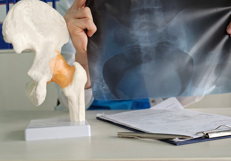 Doctor analyzes hip joint model while reviewing X-rayの写真素材