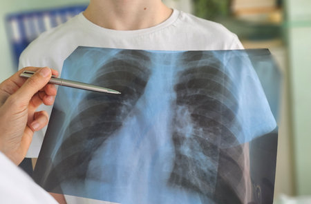 Doctor examines chest X-ray while discussing results with patient in clinicの写真素材