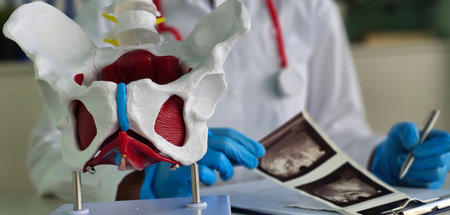 X-ray of the hip joint and ultrasound of organs. Pelvic Bone. Ultrasound examination of the hip joint in adultsの写真素材