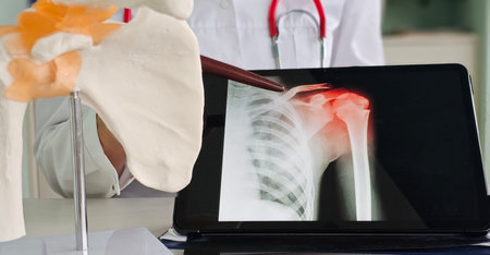 Medical professional examines shoulder injury with anatomical model and digital X-ray display in a...