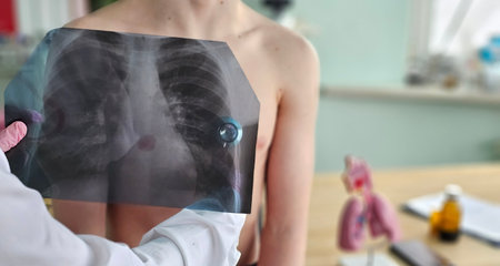 Medical professional examines chest X-ray while patient looks on in a clinical setting
