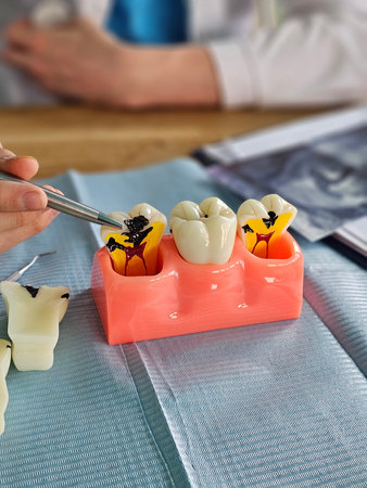 Dental student practices filling techniques using artificial teeth in a training sessionの写真素材