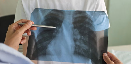 Pediatrician examines a teenage patient with a stethoscope looking at an x-ray of the lungs with...