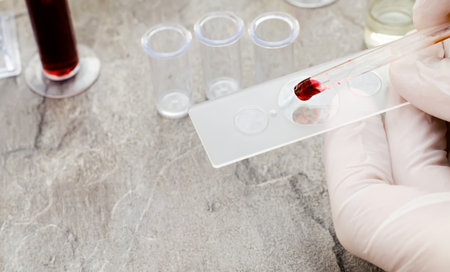 Blood testの写真素材