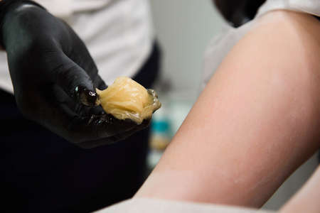 Woman Beauty. Beautician Doing Epilation On Beautiful Girls Body In Medical Center.の写真素材