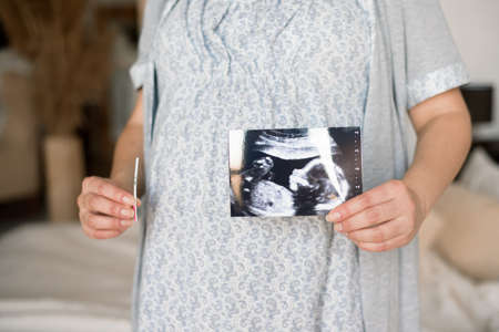 Pregnant woman looking at baby ultrasound scan.の写真素材