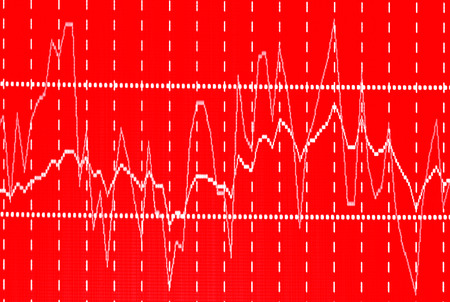 Abstract stock market diagram candle bars trade.