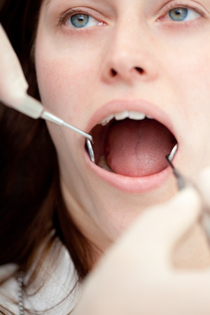 Visit to the dentistの写真素材