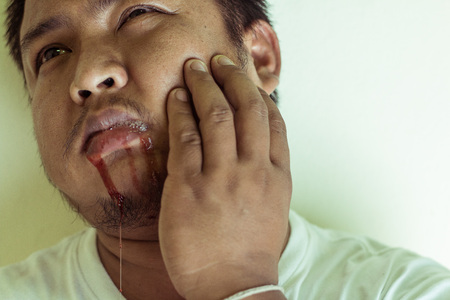Portrait of Asian young man Feel pain Then bleeding from the mouth.の写真素材