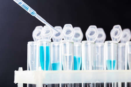 pipette and scientific laboratory test tubes in a genetic laboratory. study of a virus or...