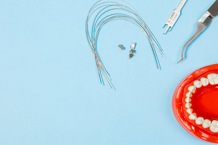 a set of special tools for an orthodontist to install braces for a patient. Orthodontic arcs, ligature, locks, positioner, tweezers, rubber bandsの写真素材