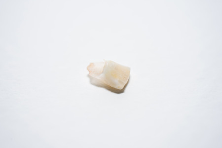 the isolade of a baby tooth with blood stain on a palm.の写真素材