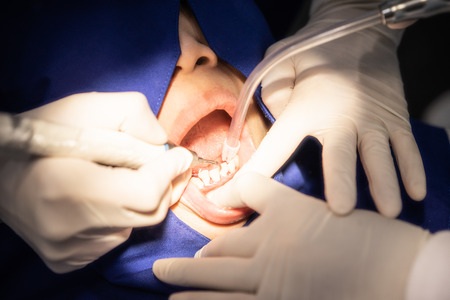 The dentist has tooth extraction and dental treatment at the clinic because of this great toothache of the woman.の写真素材