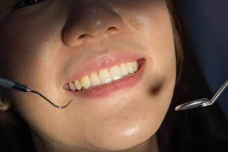 Cropped photo of smiling woman mouth under treatment at the dental clinic: Healthy lifestyle, healthcare, medicine, and teeth health concept.の写真素材