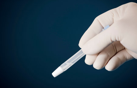 Laboratory scientist with vial and swab indoors performing a rapid diagnostic test, for antibodies,...