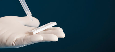 Doctor holding a test kit for viral disease tests with the COVID-19 SARS-CoV-2 laboratory card kit for the novel viral coronavirus sars cov 2 virus (formerly known as 2019-nCov)の写真素材