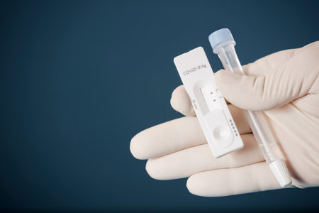 Physician who owns a COVID-19 antigen test kit with a COVID-19 2019-nCoV viral disease test kit....