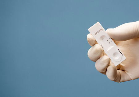 Doctor containing a COVID-19 2019-nCoV viral disease test kit. Sars-cov-2 viral coronavirus virus virus tested lab card kitの写真素材