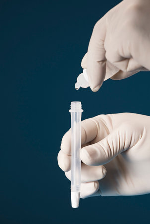 Doctor containing a COVID-19 2019-nCoV viral disease test kit. Sars-cov-2 viral coronavirus virus virus tested lab card kitの写真素材