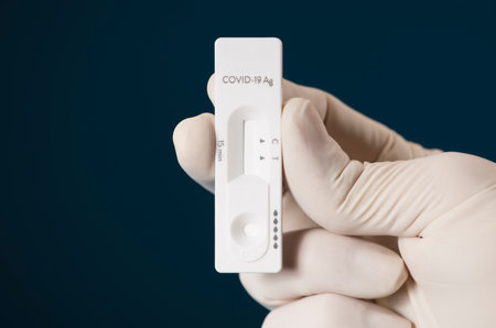 Doctor holding a test kit for viral disease tests with the COVID-19 SARS-CoV-2 laboratory card kit...