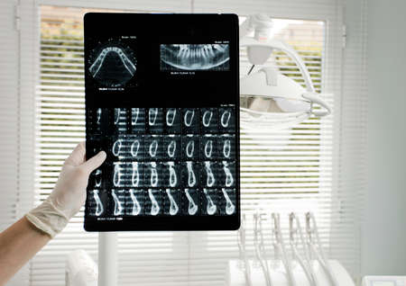 dental doctor, oral x-ray exams (oral radiography), dental clinic background