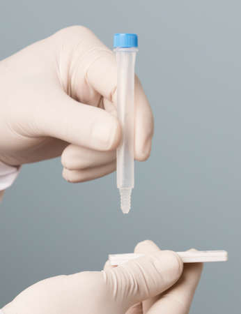 Physician who owns a COVID-19 antigen test kit with a COVID-19 2019-nCoV viral disease test kit....