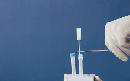 doctor or nurse with scissors and surgical gloves cuts swab, introduces into transparent vial, blue backgroundの写真素材