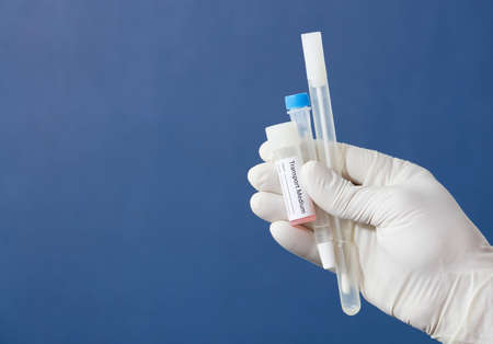 pcr analysis kit with buccal swab, nasal swab and transport medium in the hands of a doctor or nurse with white surgical gloves, blue backgroundの写真素材
