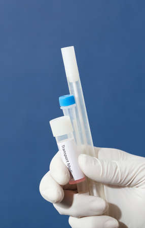 pcr analysis kit with buccal swab, nasal swab and transport medium in the hands of a doctor or nurse with white surgical gloves, blue backgroundの写真素材