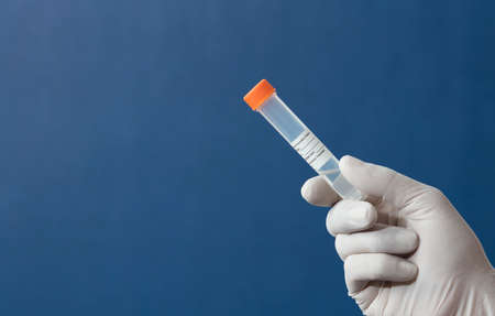 transport vial for laboratory, with red cap and sticker personal data in the hands of doctor, with blue backgroundの写真素材