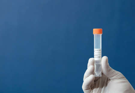 transport vial for laboratory, with red cap and sticker personal data in the hands of doctor, with blue backgroundの写真素材