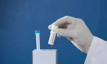 pcr kit in the hands of a doctor with surgical gloves, places medium transport tubes in cardboard support, blue backgroundの写真素材