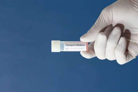 transport vial for laboratory, with sticker personal data in the hands of doctor, with blue backgroundの写真素材