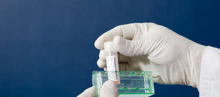 transport vial for laboratory, with sticker personal data in the hands of doctor, with blue backgroundの写真素材