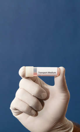 transport vial for laboratory, with sticker personal data in the hands of doctor, with blue backgroundの写真素材