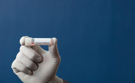 transport vial for pcr test, in the hands of a doctor, nurse, pharmacist, with blue backgroundの写真素材