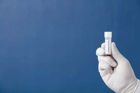 transport vial for pcr test, in the hands of a doctor, nurse, pharmacist, with blue backgroundの写真素材