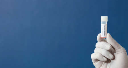 transport vial for pcr test, in the hands of a doctor, nurse, pharmacist, with blue backgroundの写真素材